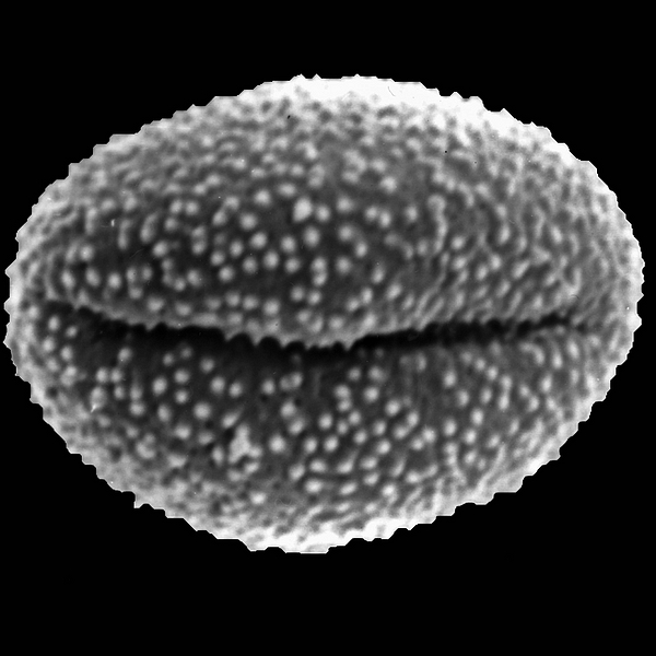 Pollen grain of Sesuvium edmondstonii (scanning electron micrograph). Photo: Patricia Jaramillo Díaz & M. Mar Trigo, CDF, 2011.