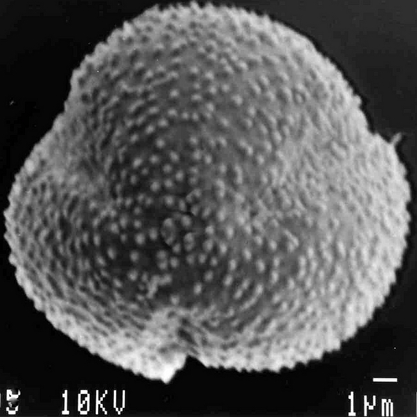 Pollen grain of Sesuvium edmondstonii (scanning electron micrograph). Photo: Patricia Jaramillo Díaz & M. Mar Trigo, CDF, 2011.